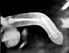 x-ray.jpg